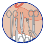 proctologo, qué son hemorroides, las verrugas, como son hemorroides, una verruga, proctologos en el, tratamiento hemorroides, como se forma una verruga, proctologos, el proctologo, qué es una verruga, medico proctologo, especialista en hemorroides, sangrar ano, q son hemorroides, cancer de colon, especialista proctologo