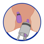 proctologo, qué son hemorroides, las verrugas, como son hemorroides, una verruga, proctologos en el, tratamiento hemorroides, como se forma una verruga, proctologos, el proctologo, qué es una verruga, medico proctologo, especialista en hemorroides, sangrar ano, q son hemorroides, cancer de colon, especialista proctologo